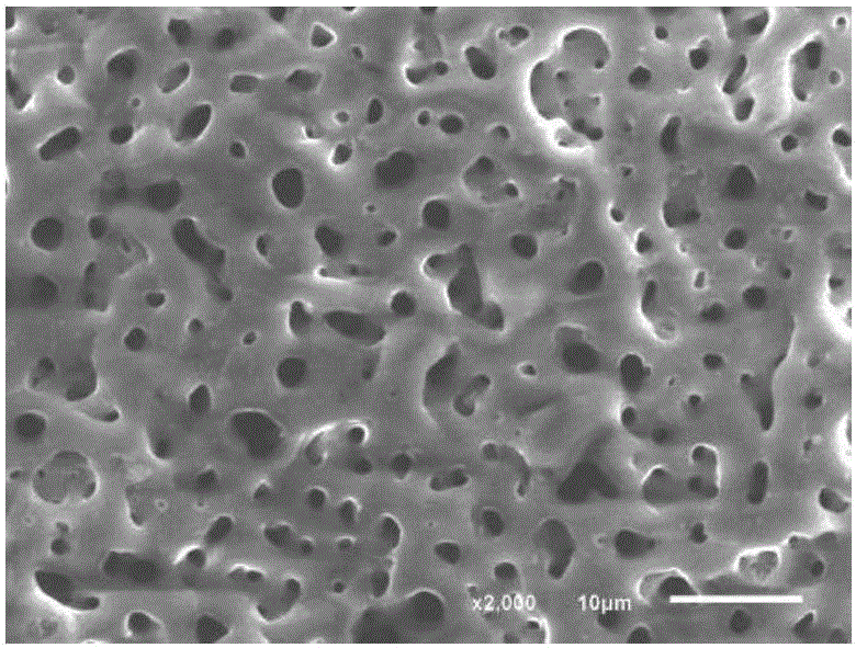 Method for preparing bio-coating on surface of magnesium alloy by combining laser shock with micro-arc oxidation
