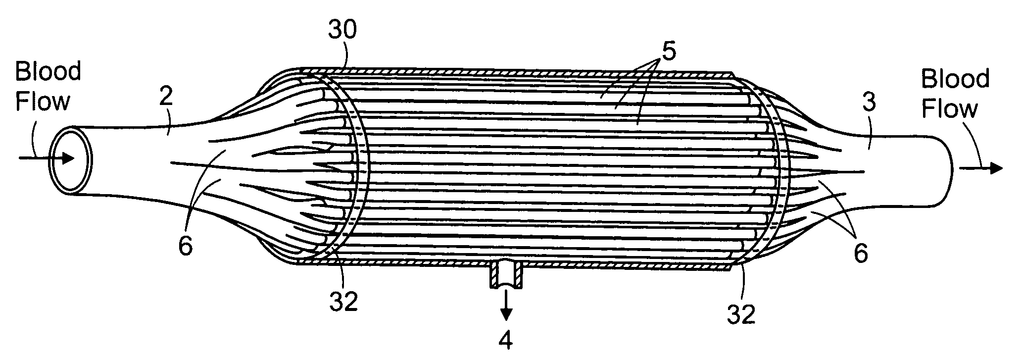 Device for removing fluid from blood in a patient