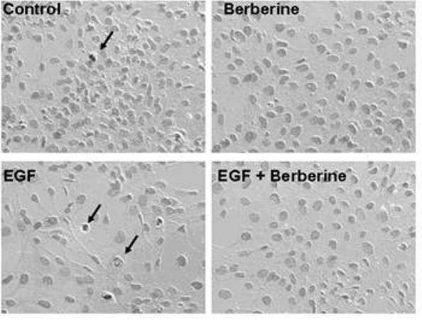 Application of berberine to preparing drug for preventing and treating familial adenomatous polyp