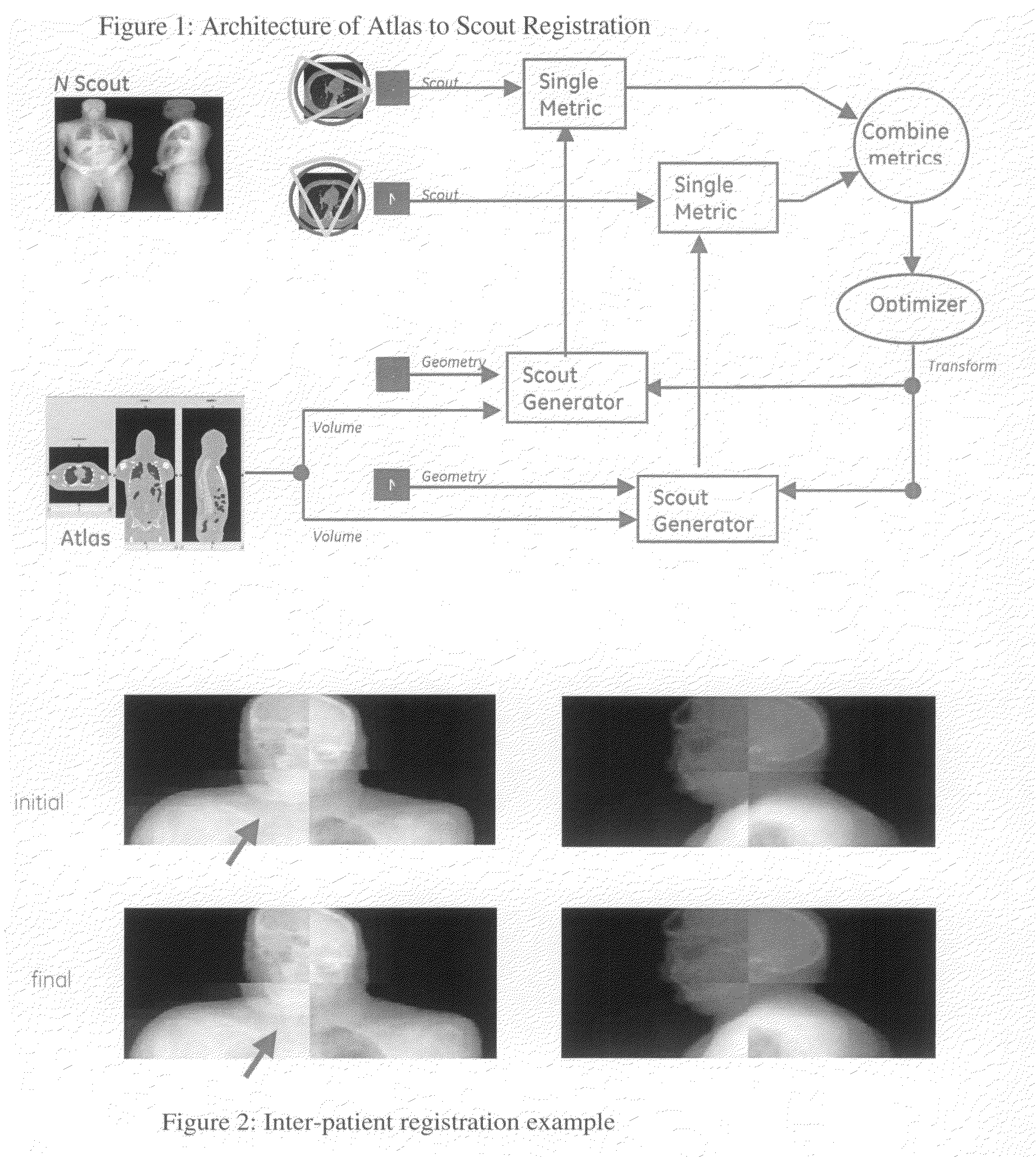 System and method for automated patient anatomy localization