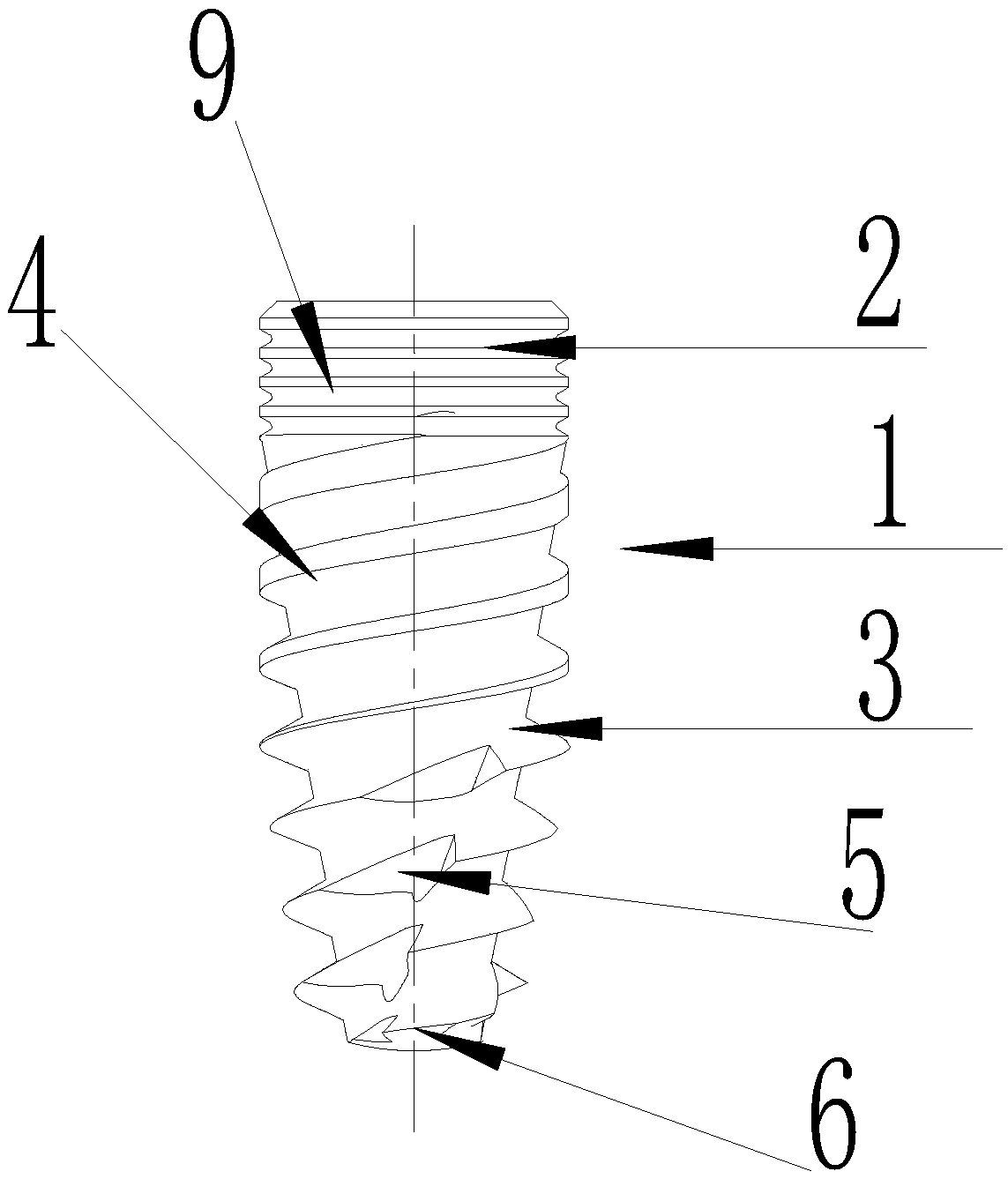 Implant with bone absorption resistance