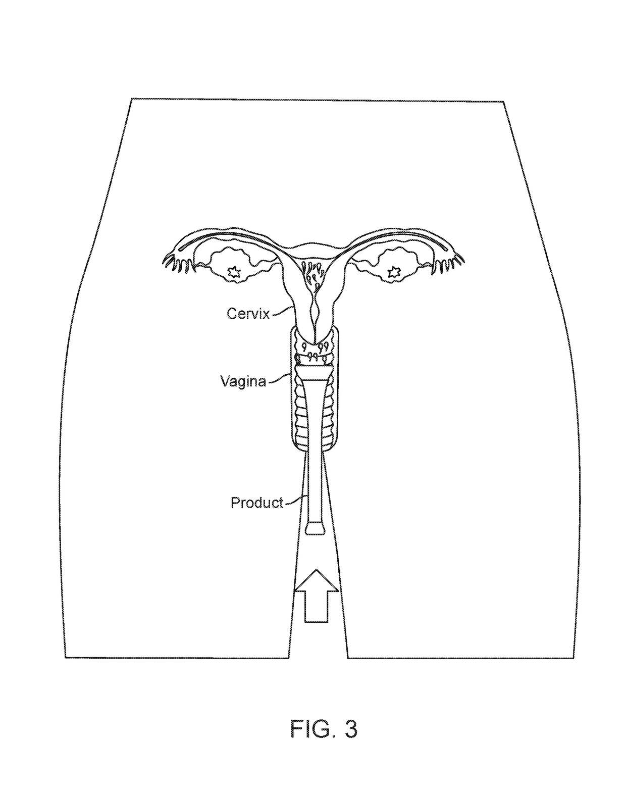 Intravaginal fertility device