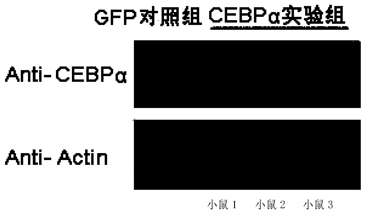CAS9-carrying recombinant adenovirus and application thereof