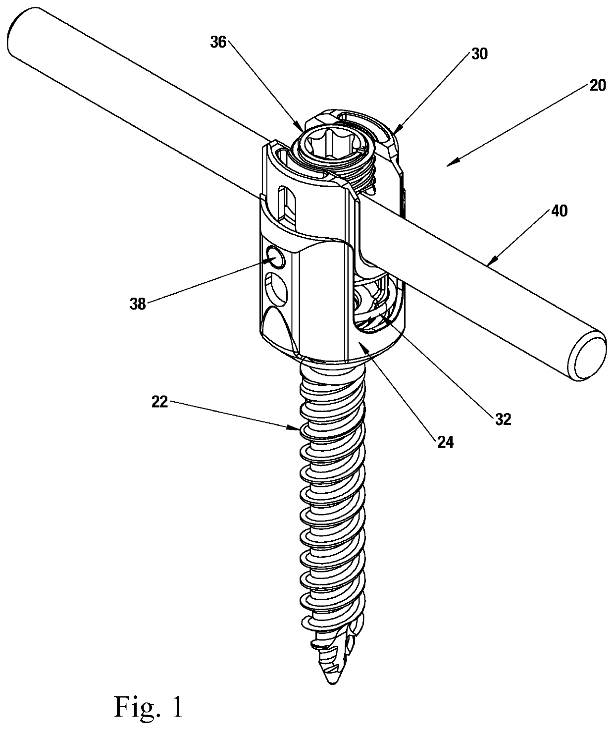 Bone screw