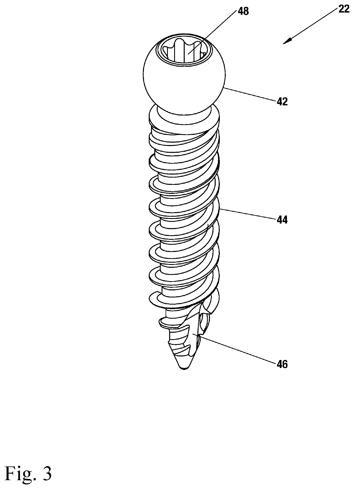 Bone screw