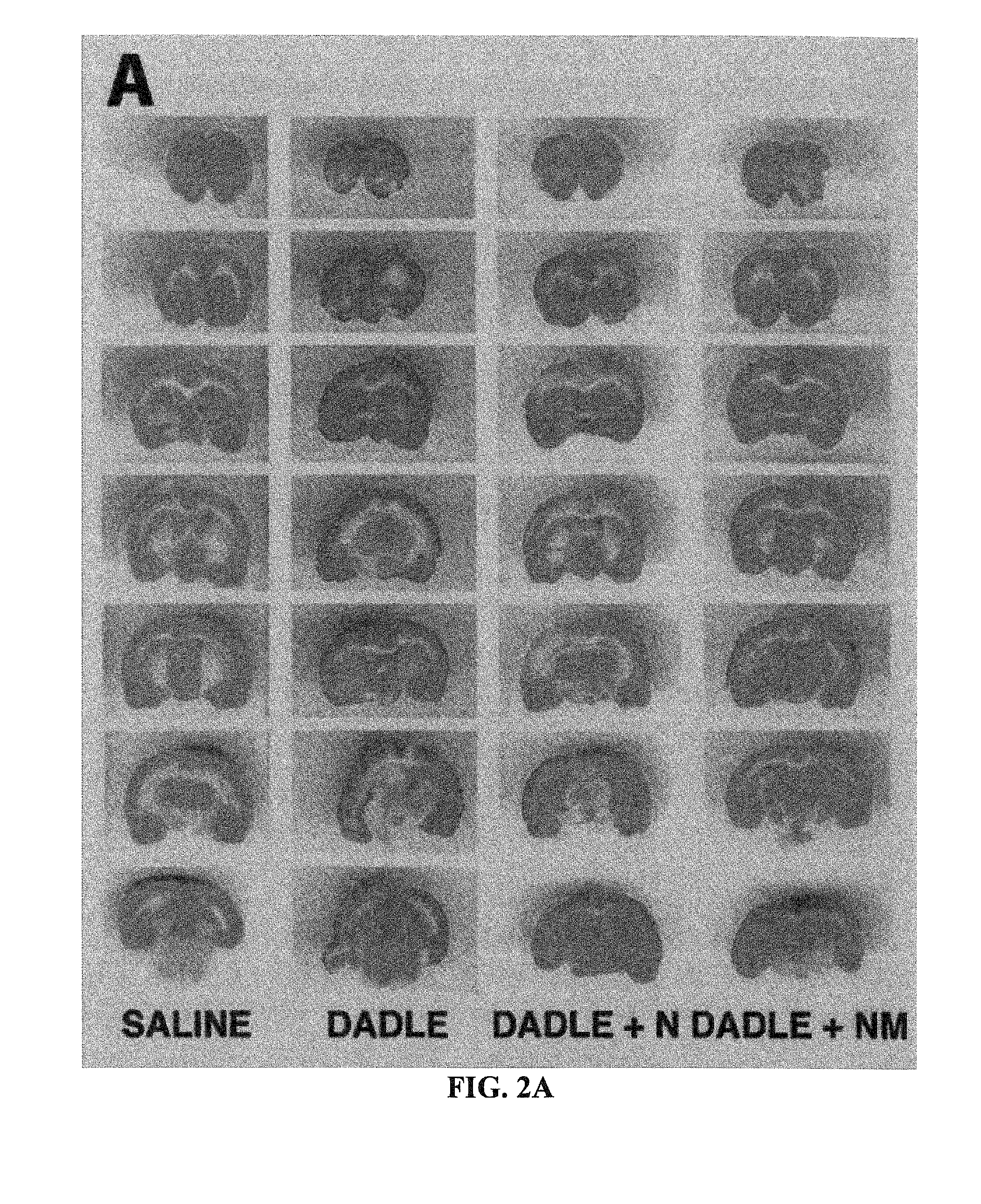 Method of protecting against stroke through the use of a delta opioid peptide