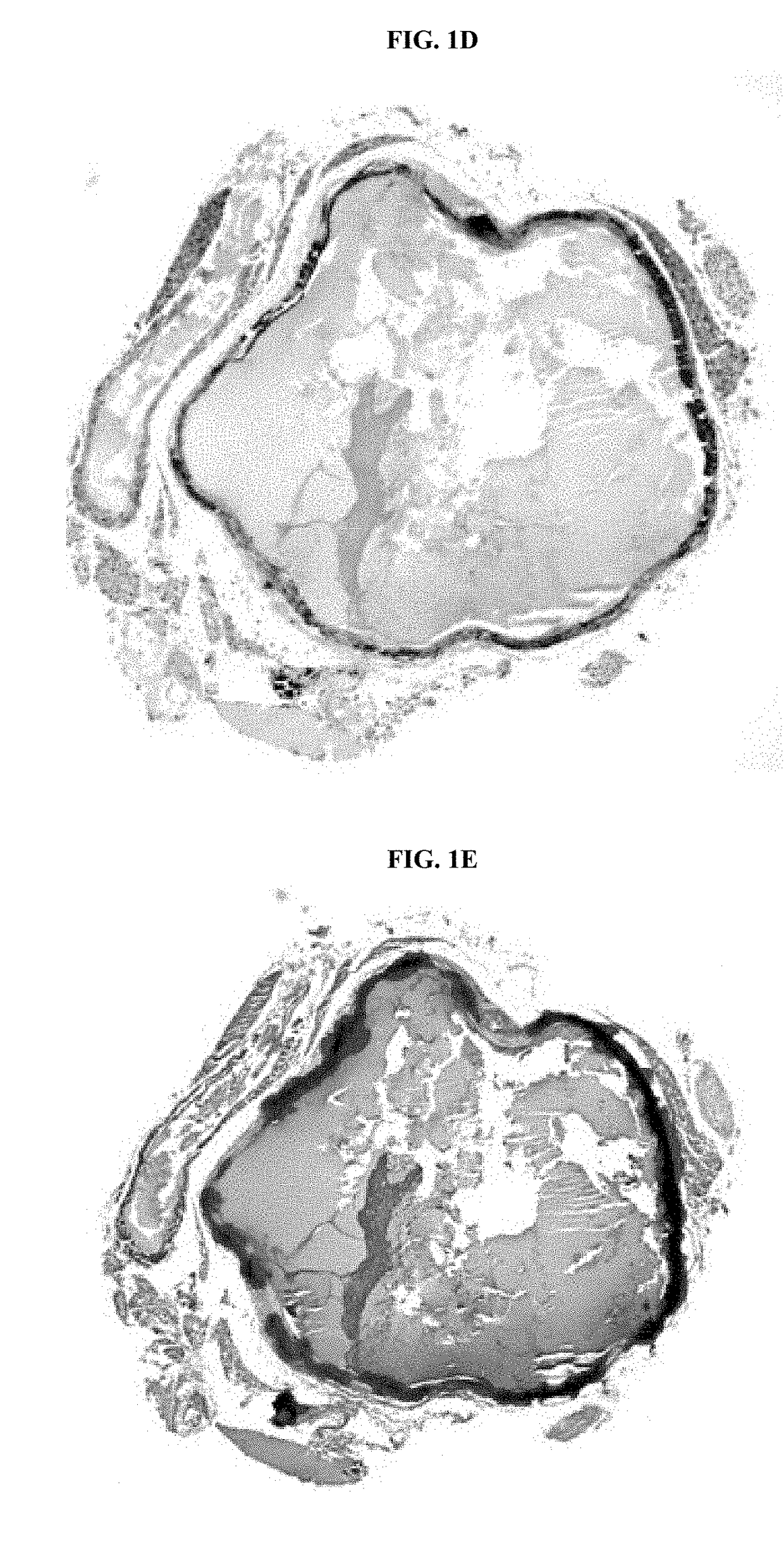 Compositions for Treating Pathological Calcification Conditions, and Methods Using Same