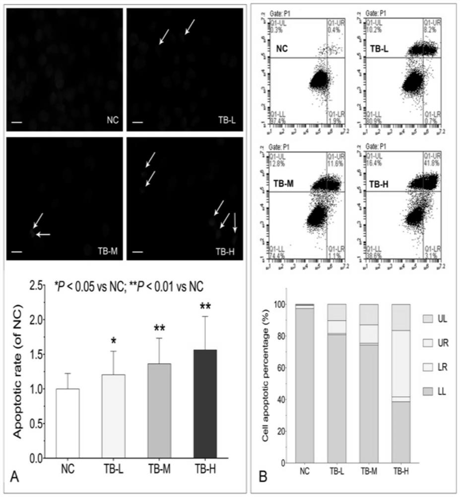 Application of theabrownin in preparation of medicine for treating liver cancer