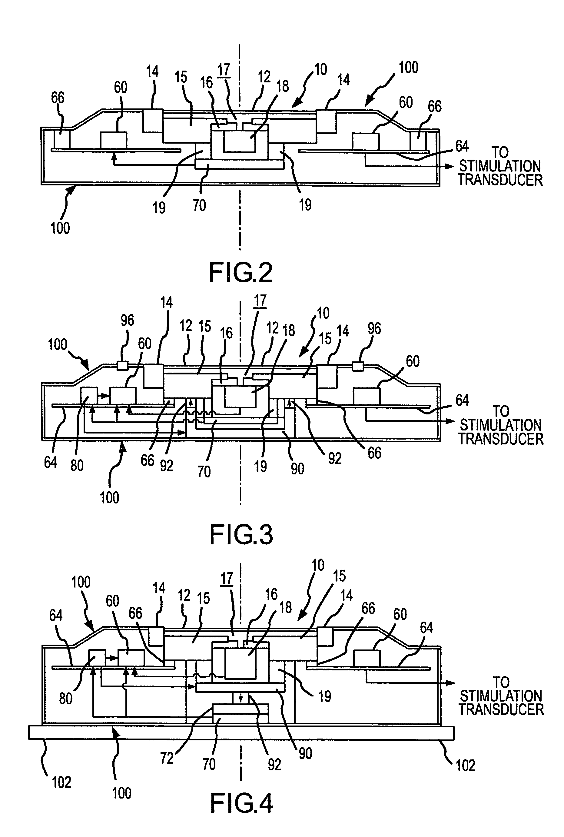 Active vibration attenuation for implantable microphone