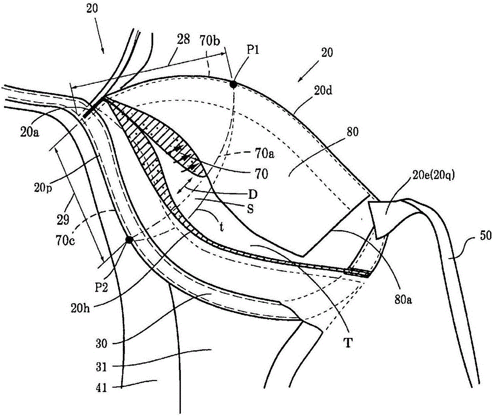 Brassiere