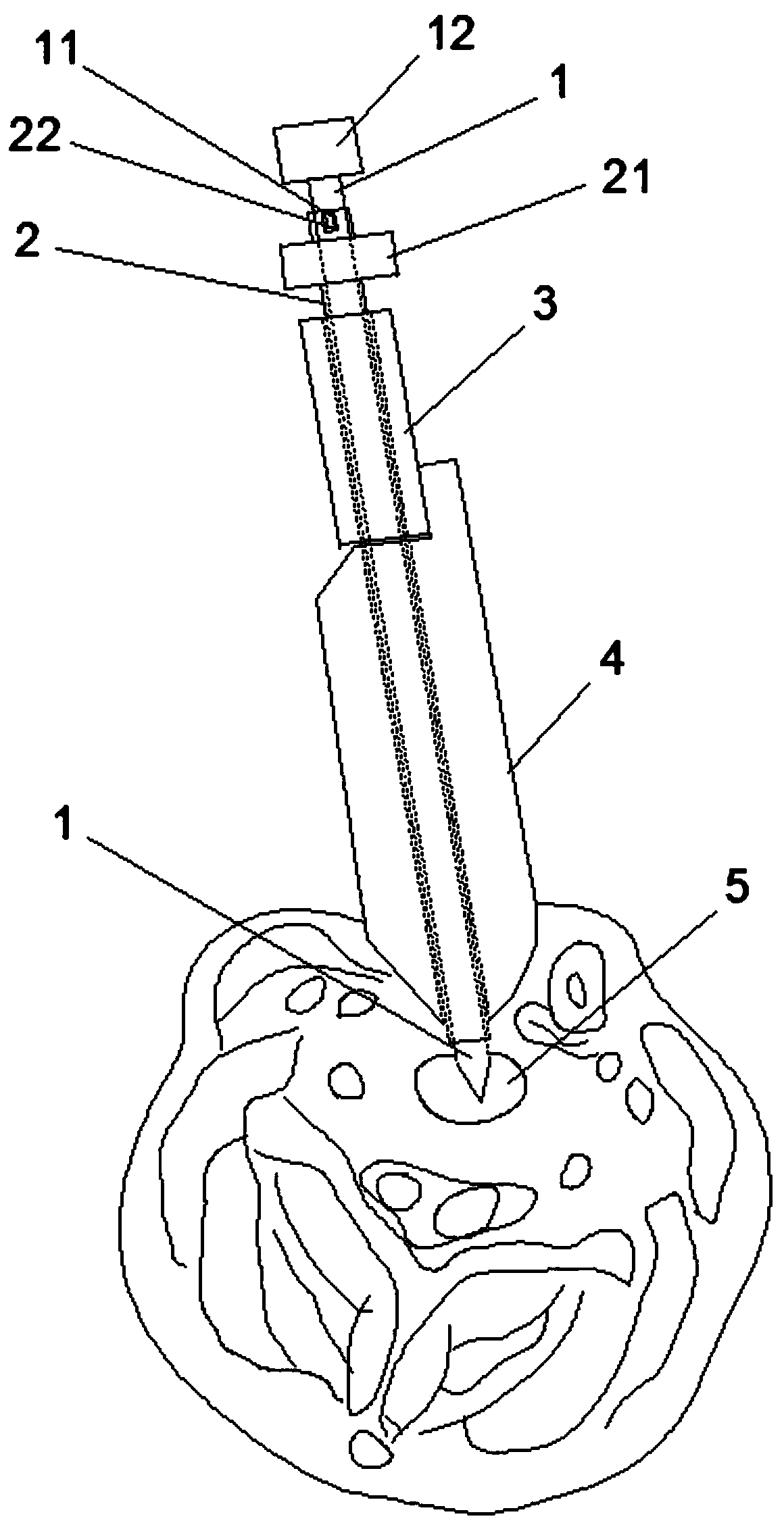 Real-time ultrasonic percutaneous puncture suction biopsy injection device