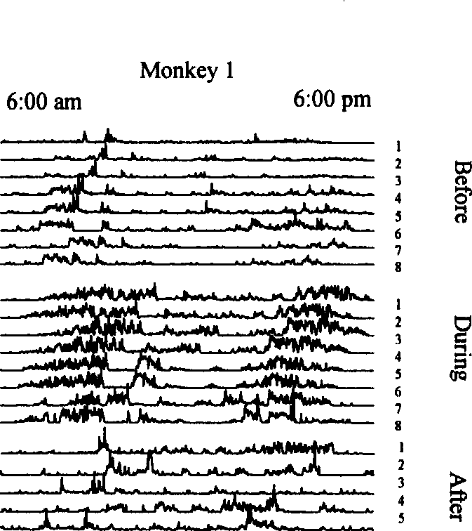 Constitution method of monkey hyperkinesia animal model