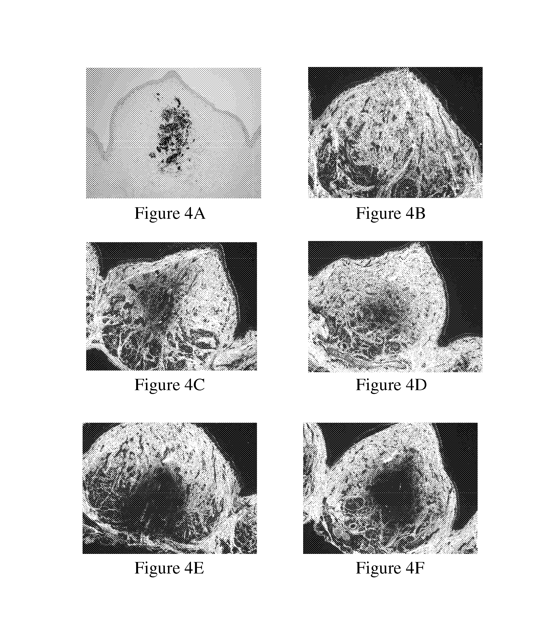 Methods For Extracting A Tooth