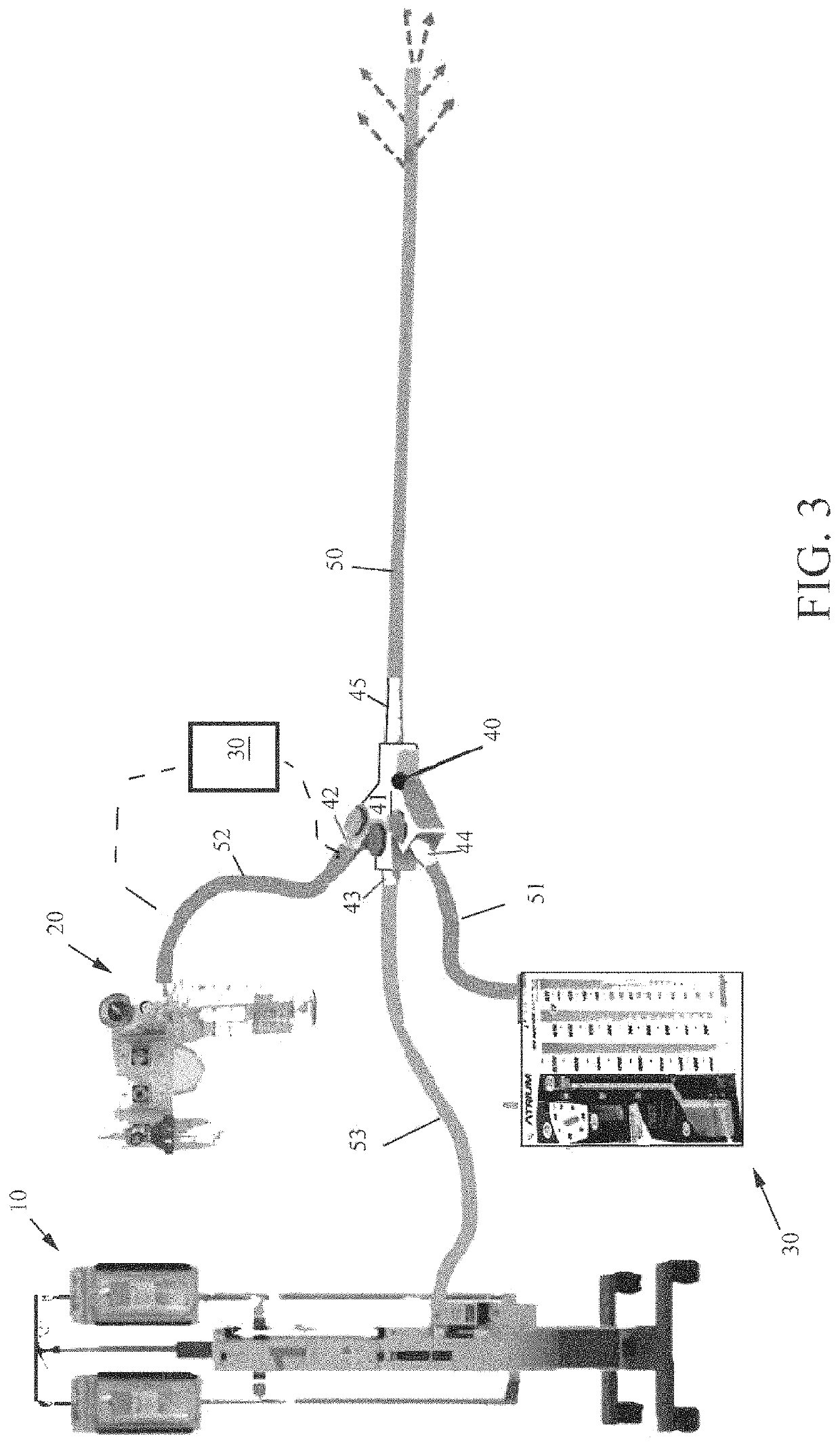 System for improving fluid drainage