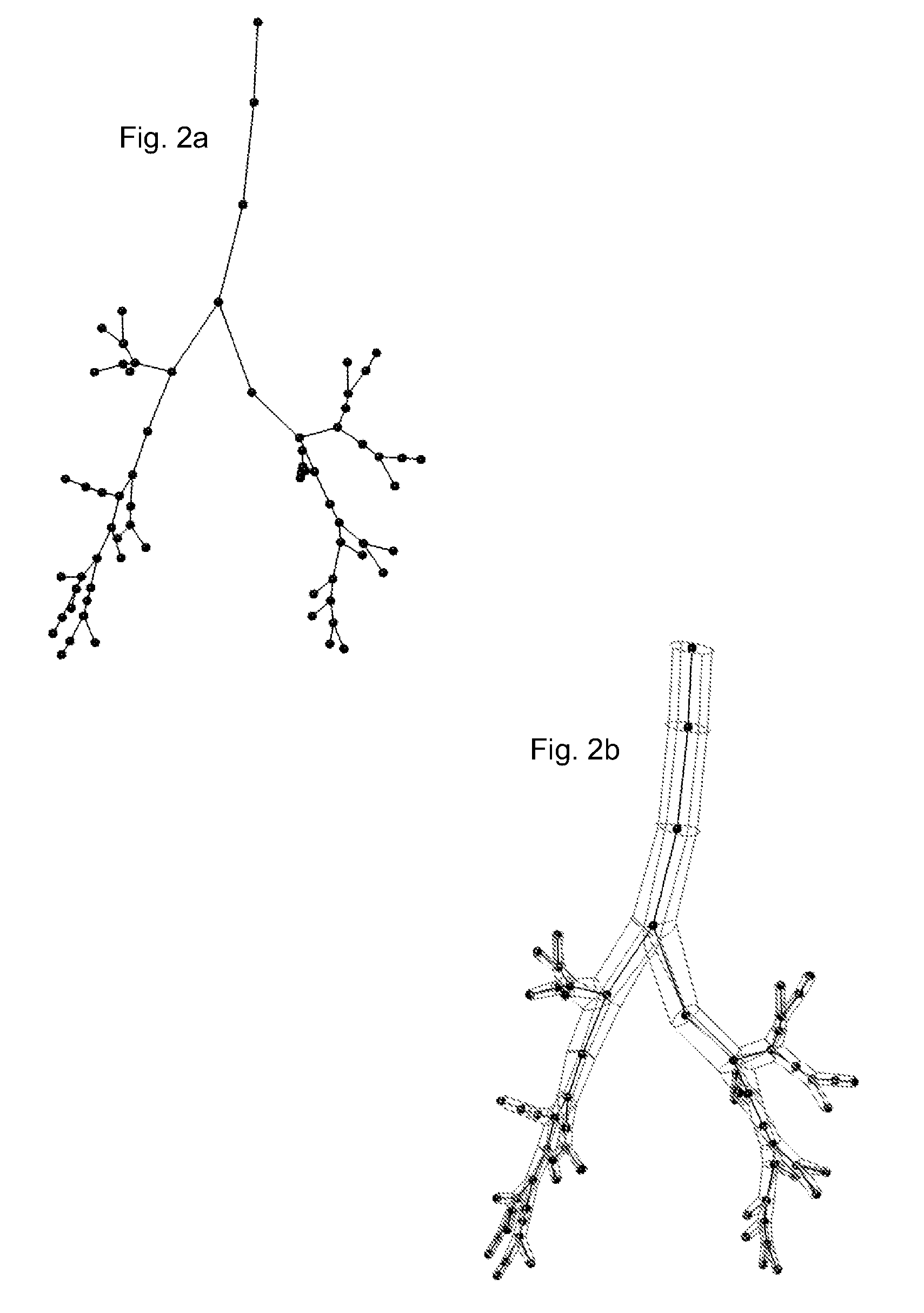 Method for multi-scale meshing of branching biological structures