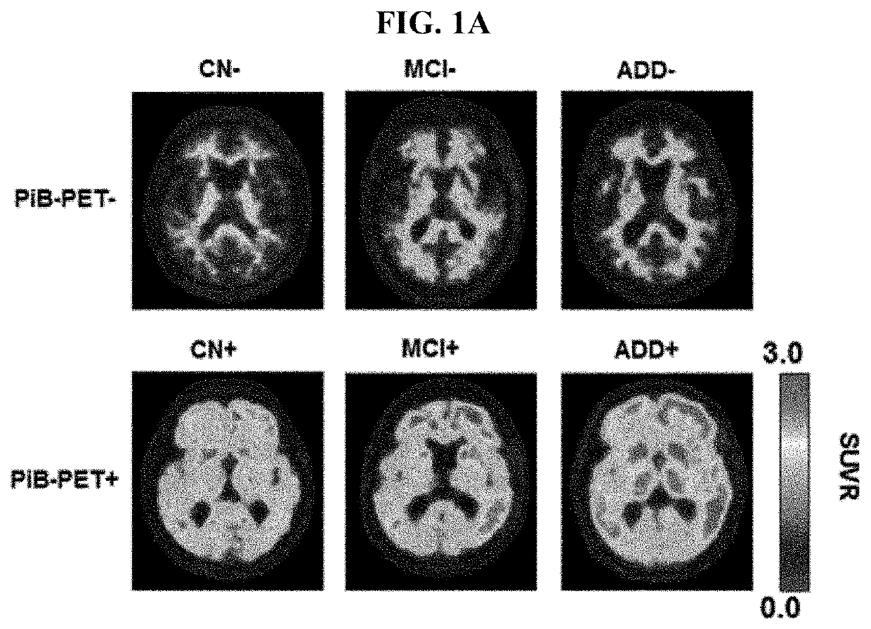 Blood biomarker for discerning beta amyloid accumulation in brain