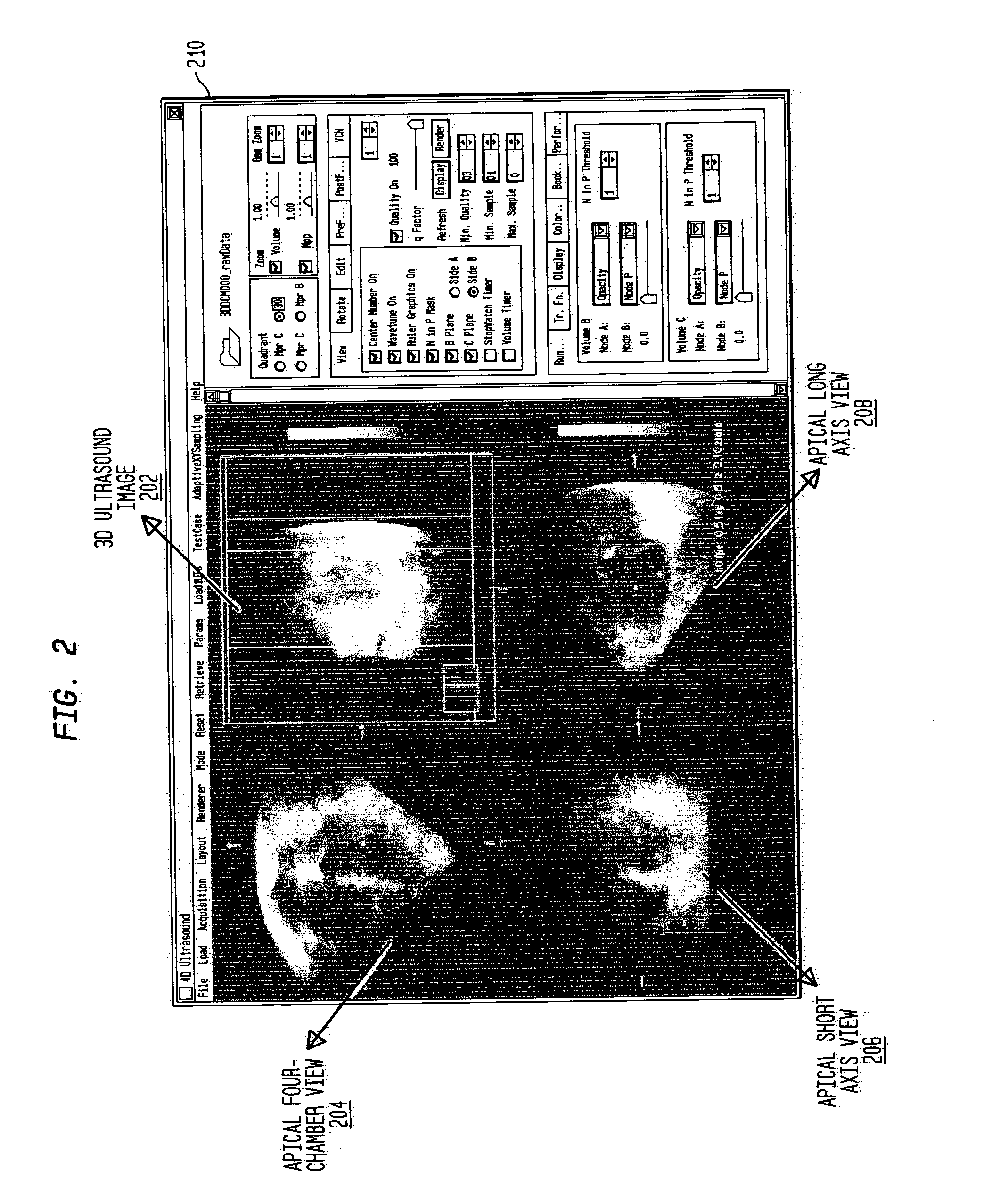 System and method for tracking anatomical structures in three dimensional images