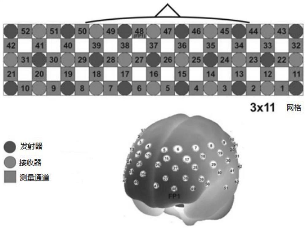 An auxiliary diagnosis system for Alzheimer's disease based on fnirs and graph neural network