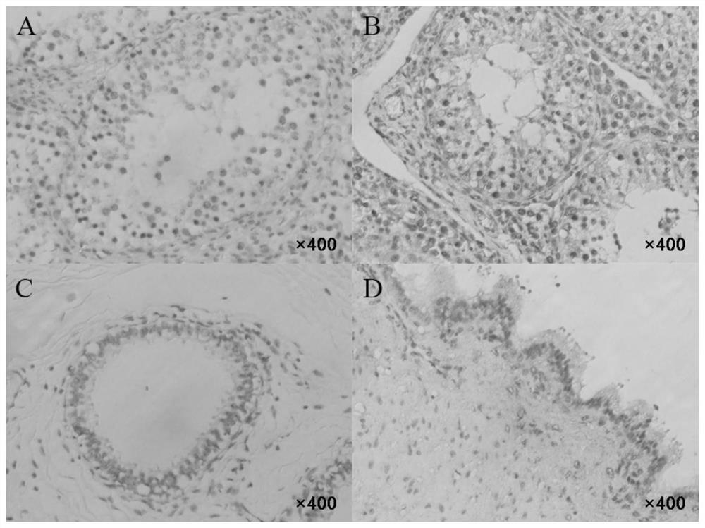 A sperm protein marker spaca4 closely related to the reproductive performance of breeding boars and its application
