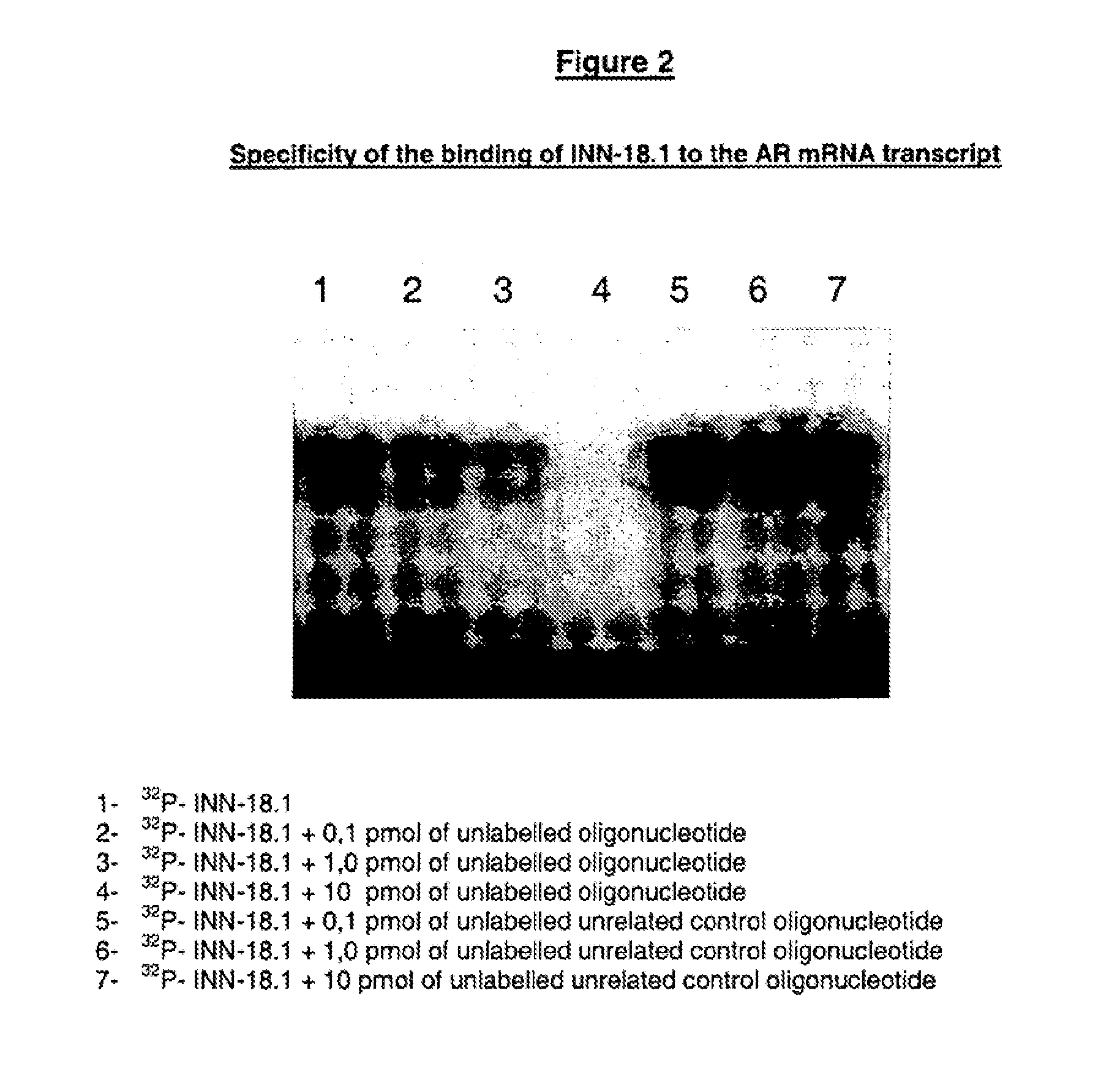 Antiandrogen oligonucleotides usable for the treatment of dermatological androgen-related disorders relating to androgen metabolism, their pharmaceutical compositions, their uses and treatment method