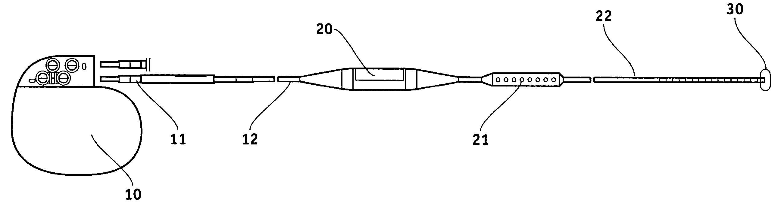 Electrical lead body including an in-line hermetic electronic package and implantable medical device using the same
