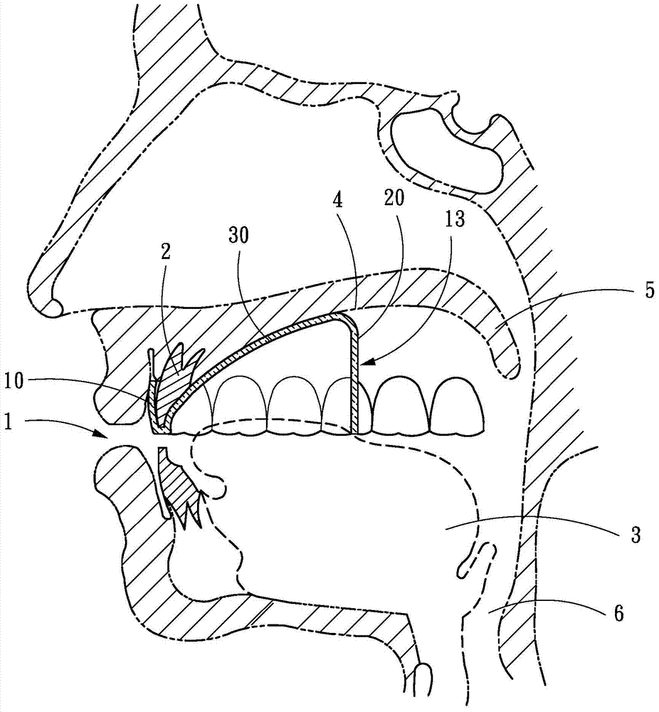 Air flow interference type stuffy nose relieving snore-ceasing device