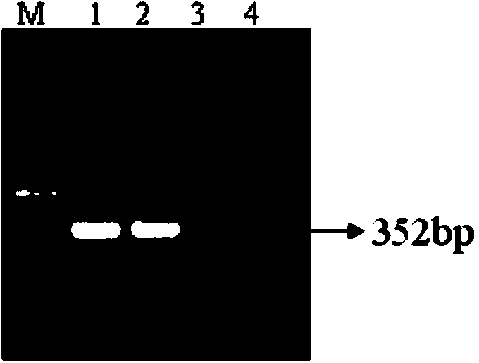 Canna yellow mottle virus nested PCR detection kit and its detection method