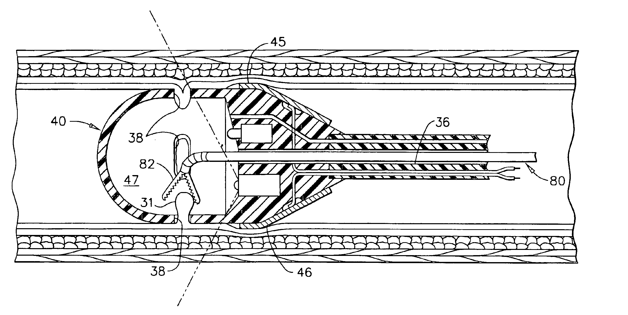Self-propelled, intraluminal device with working channel and method of use