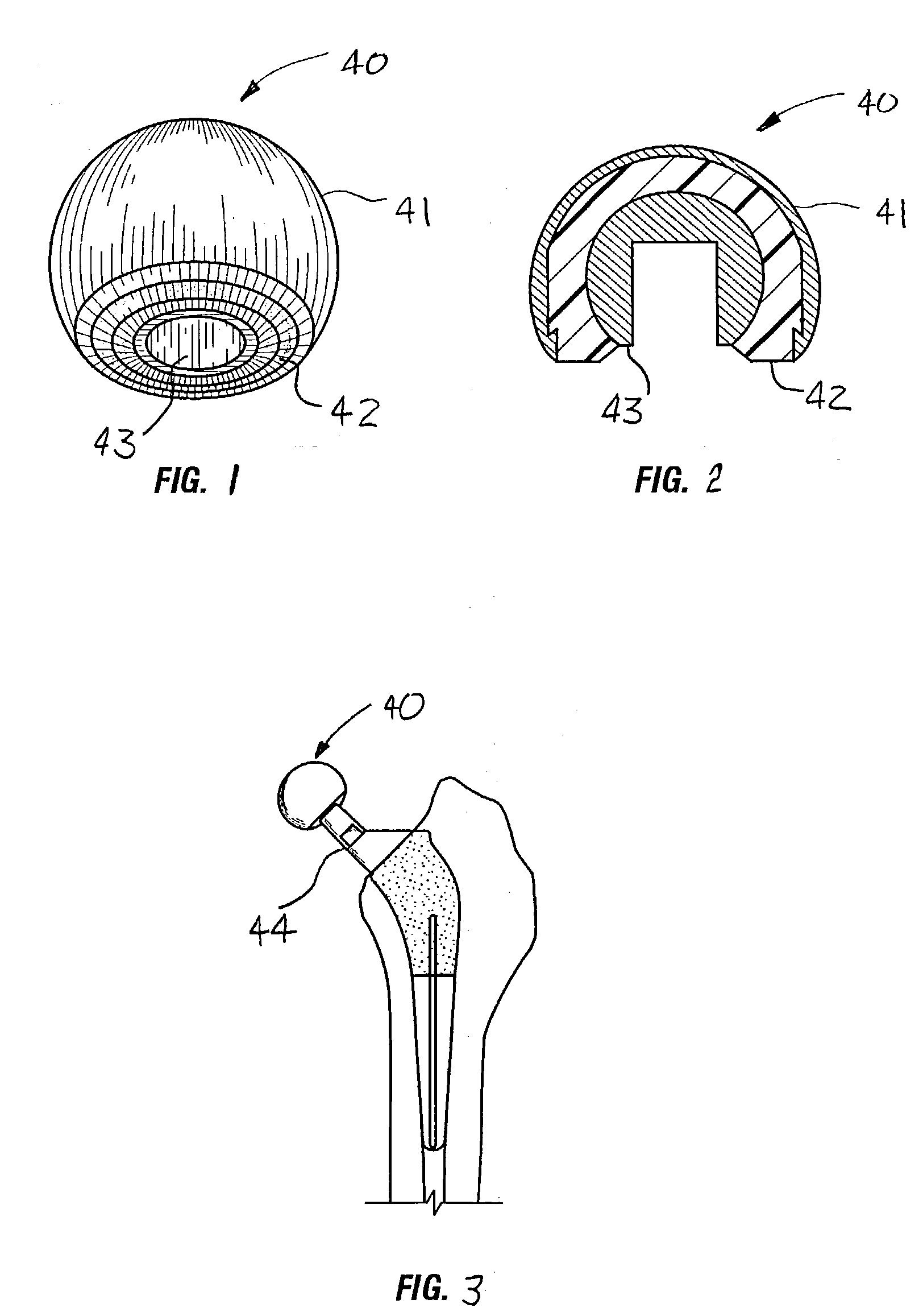 Bi-polar hip prosthetic devices employing diffusion-hardened surfaces