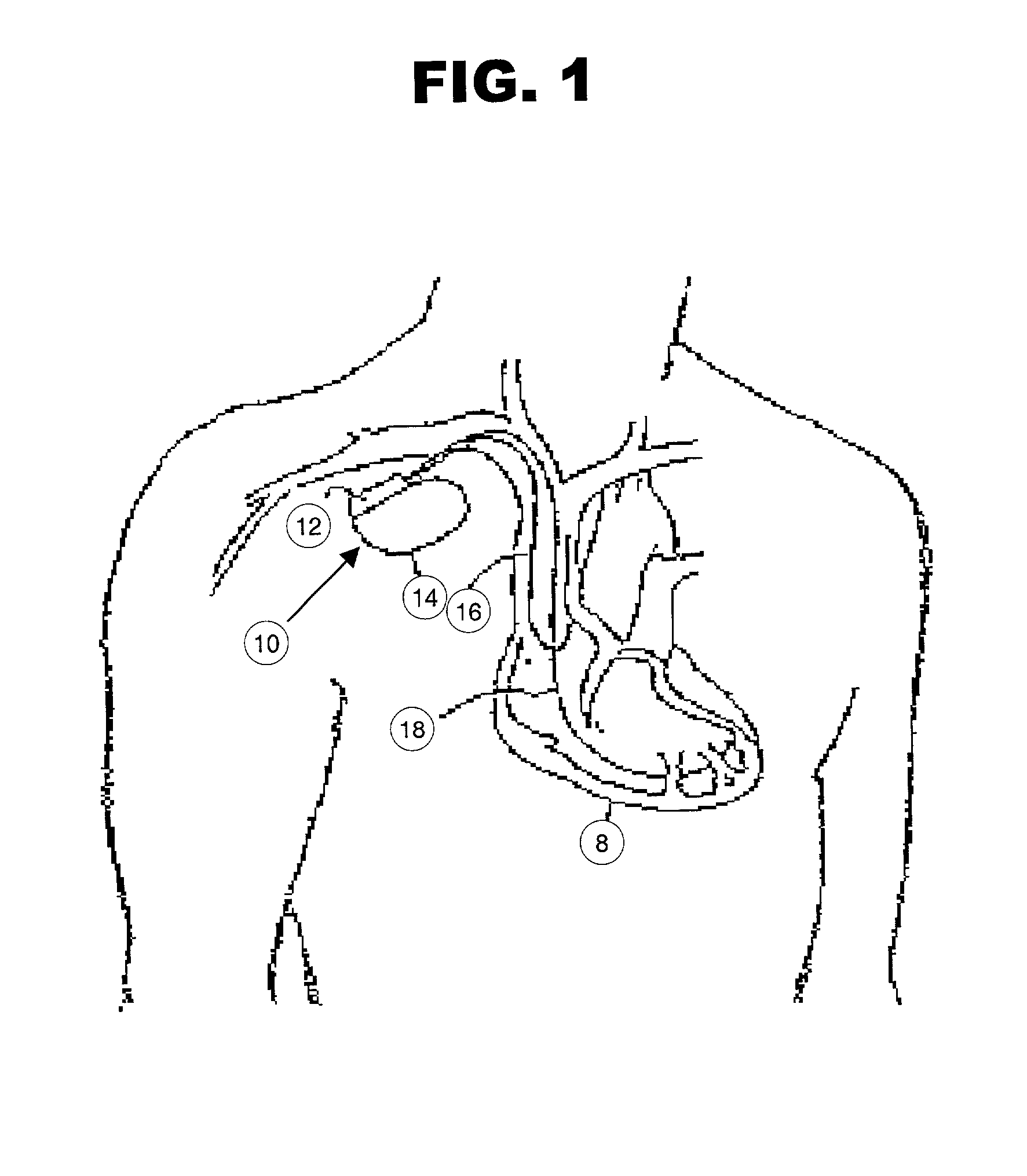 Method and system for diagnosing and administering therapy of pulmonary congestion