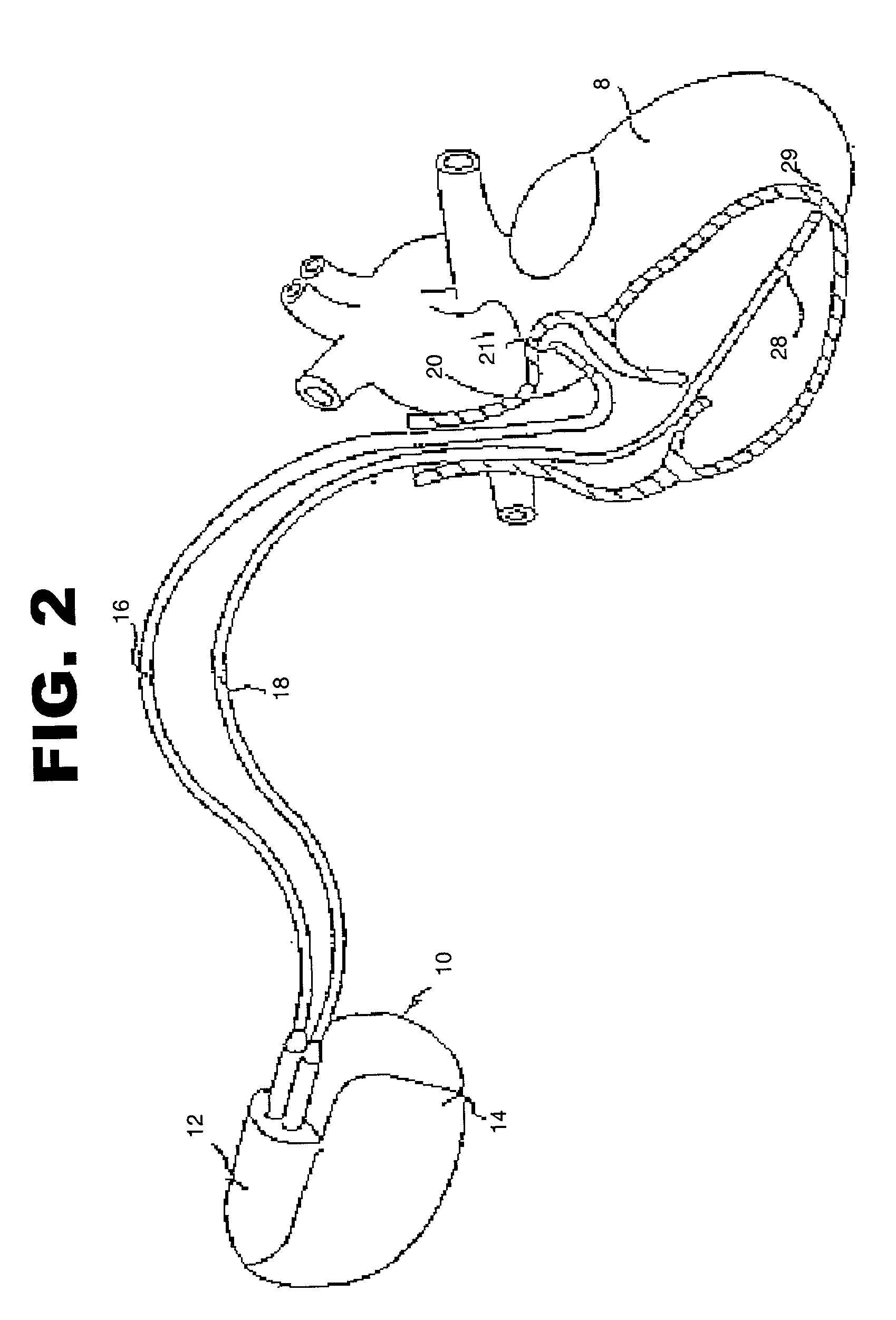 Method and system for diagnosing and administering therapy of pulmonary congestion