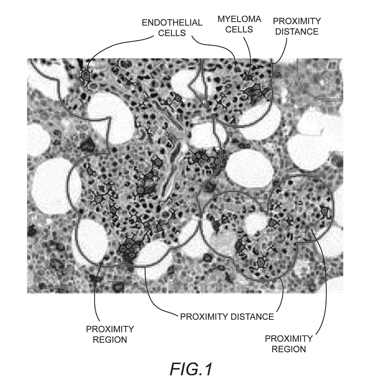 Methods for measuring and reporting vascularity in a tissue sample