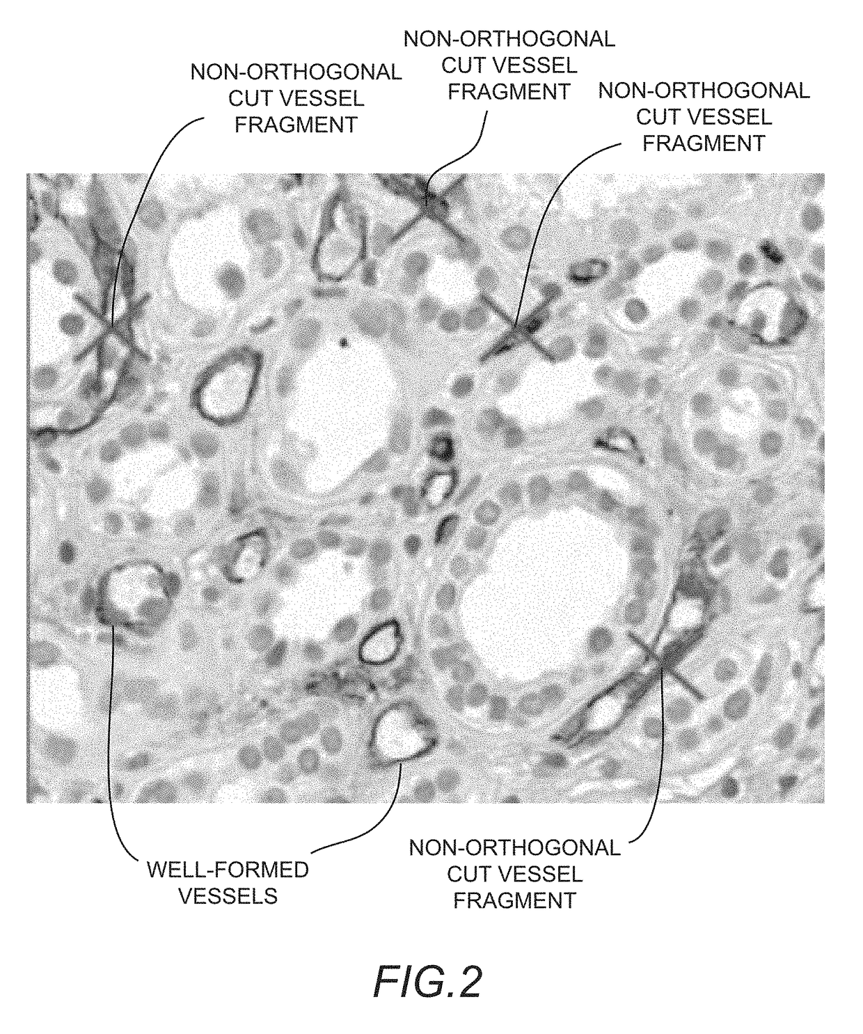 Methods for measuring and reporting vascularity in a tissue sample