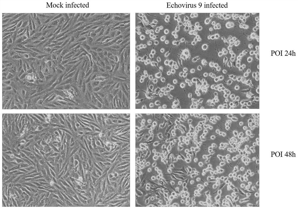Application of epigallocatechin gallate in preparation of medicine for treating and/or preventing diseases caused by Epigallocatechin gallate virus infection