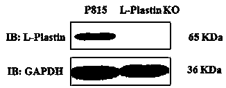Use of L-Plastin gene