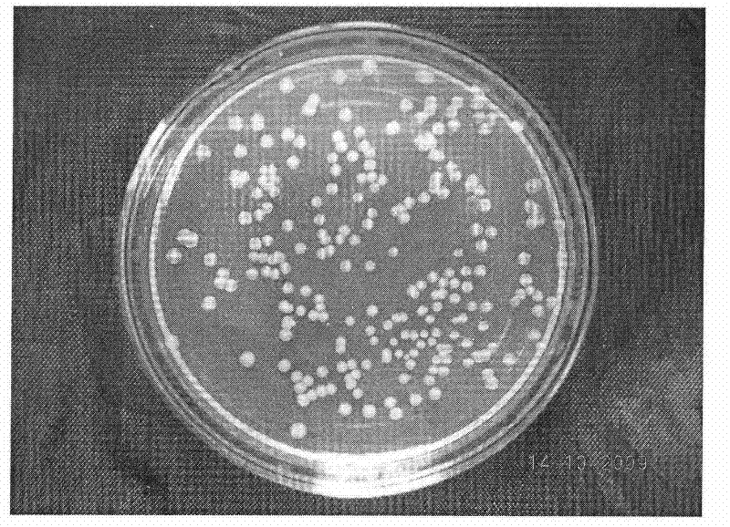 A kind of Arthrobacter hw08 degrading swainsonine and its application