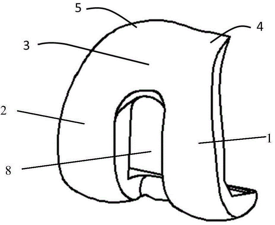 Preartis-matching femoral prosthesis for artificial knee joint