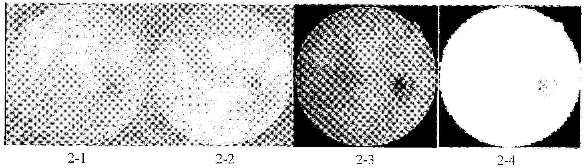 Method for positioning optic disk for eye fundus image on basis of PC (Phase Congruency)