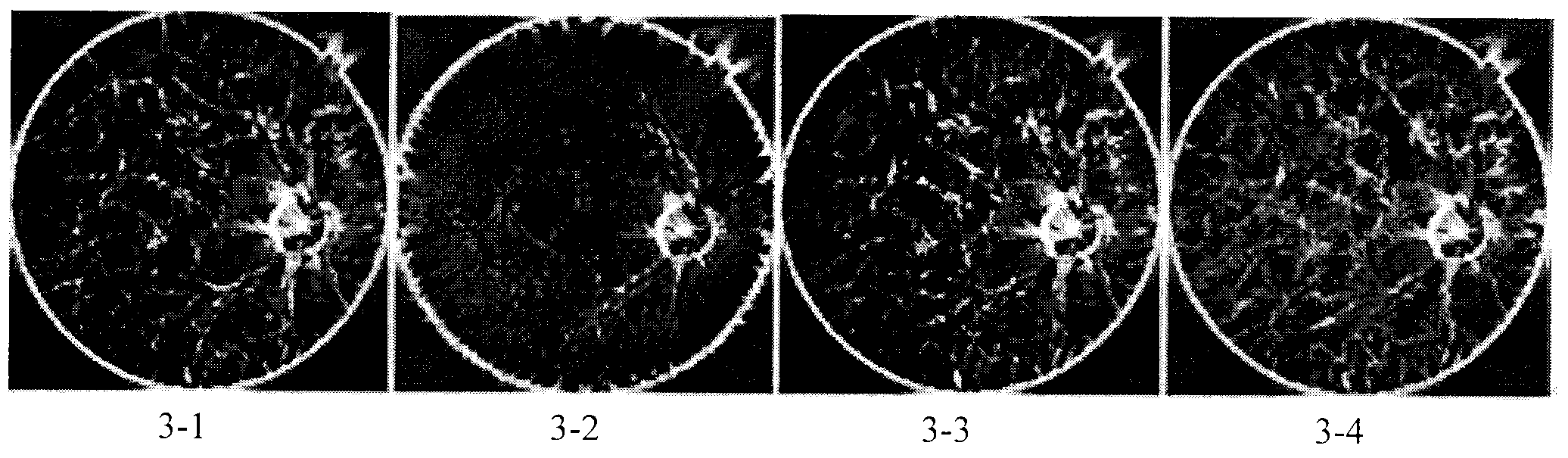 Method for positioning optic disk for eye fundus image on basis of PC (Phase Congruency)