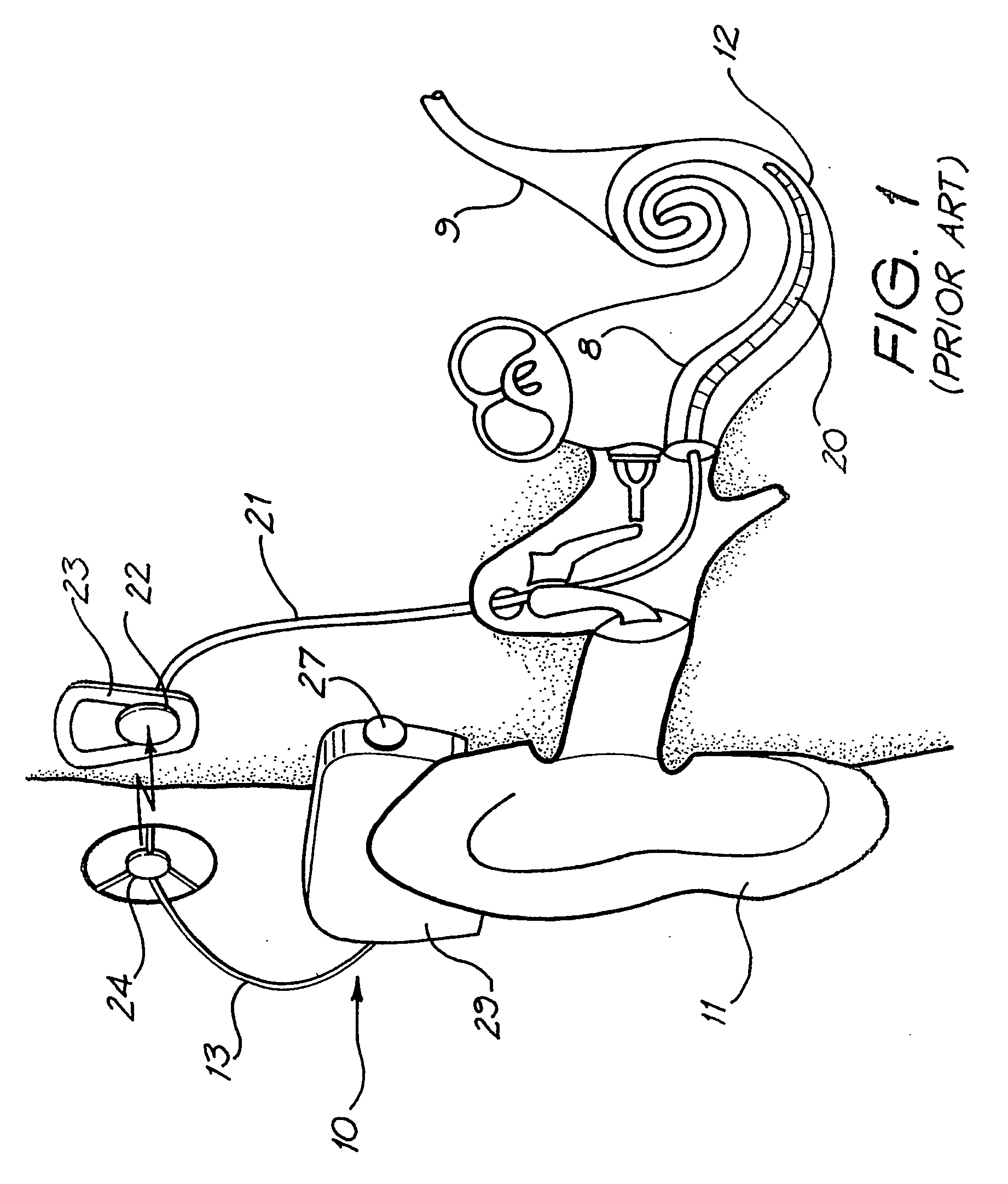 Fixation system for an implantable medical device