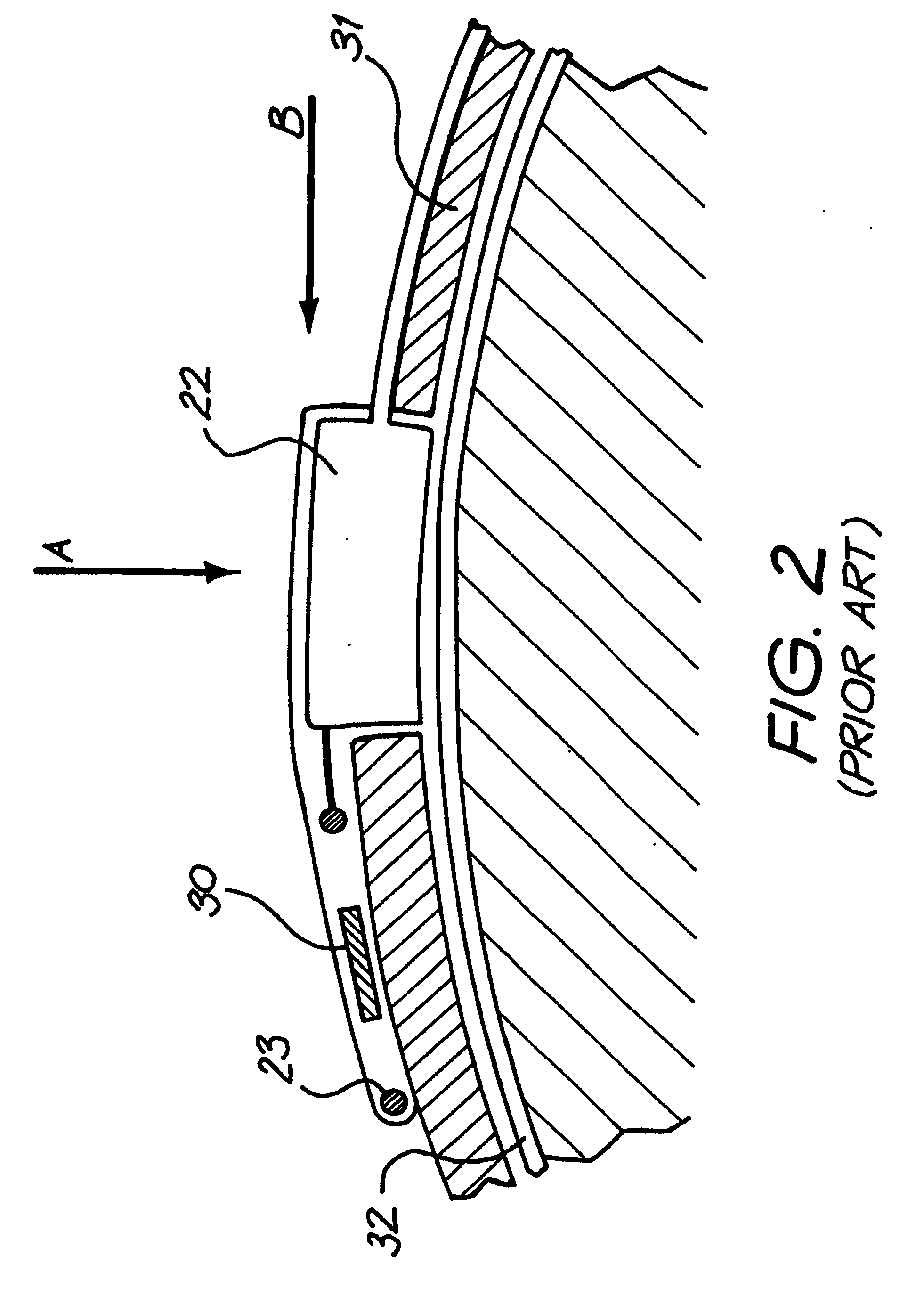 Fixation system for an implantable medical device