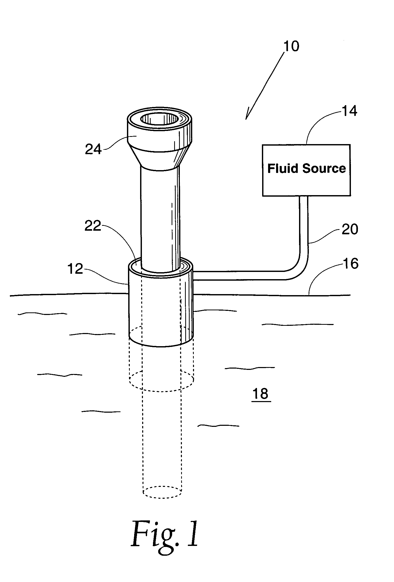 Method and apparatus for preventing air embolisms