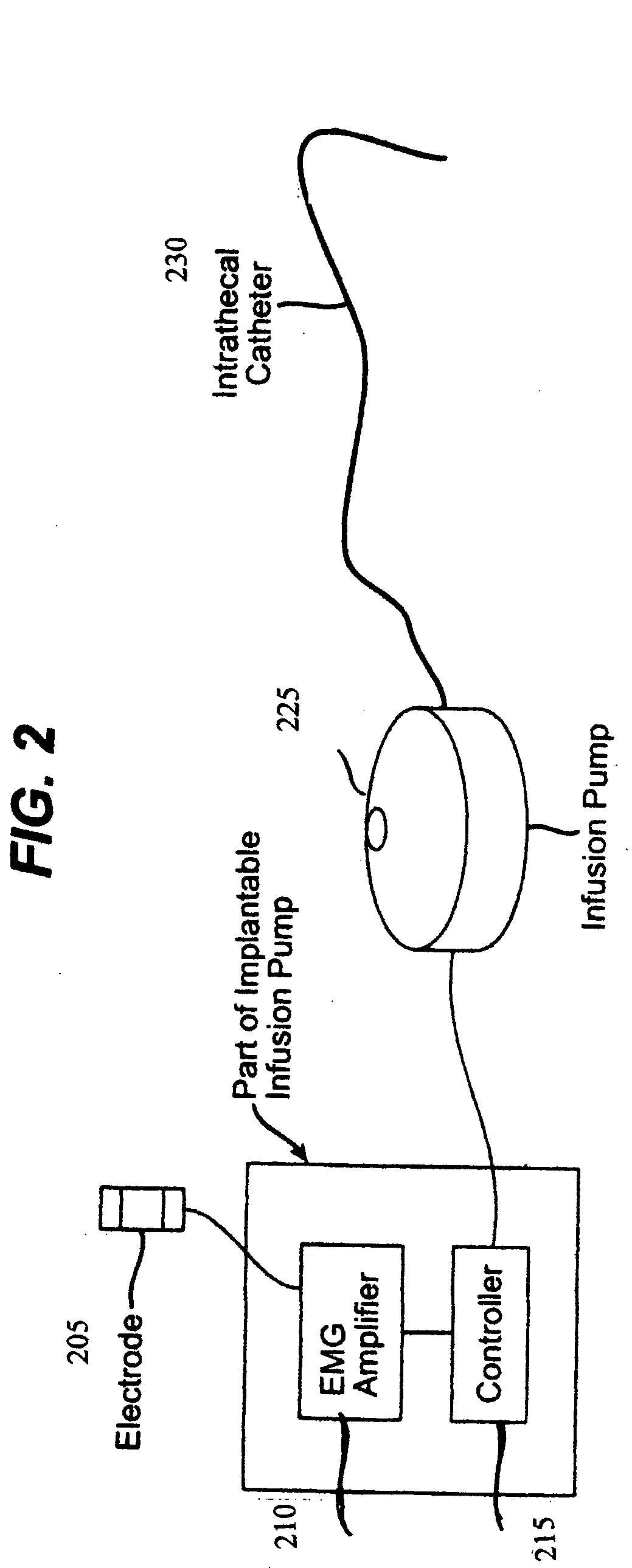 Closed loop system and method for controlling muscle activity via an intrathecal catheter