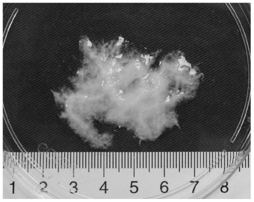 Method for preparing calcium alginate-fat acellular matrix microcarrier by applying micro-fluidic chip