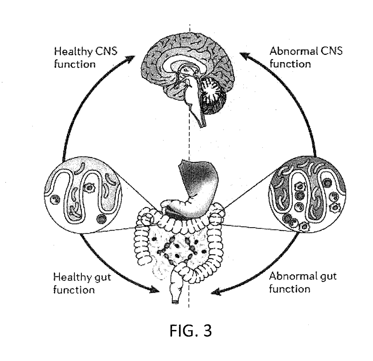 Method and System for Preventing Migraine Headaches, Cluster Headaches and Dizziness
