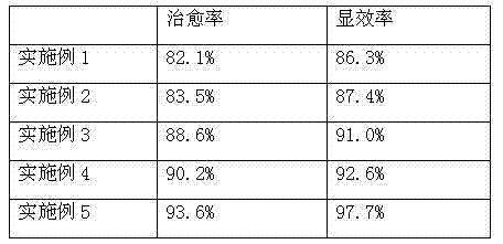 Traditional Chinese medicine composition for treating tinnitus, decoction and preparation method thereof
