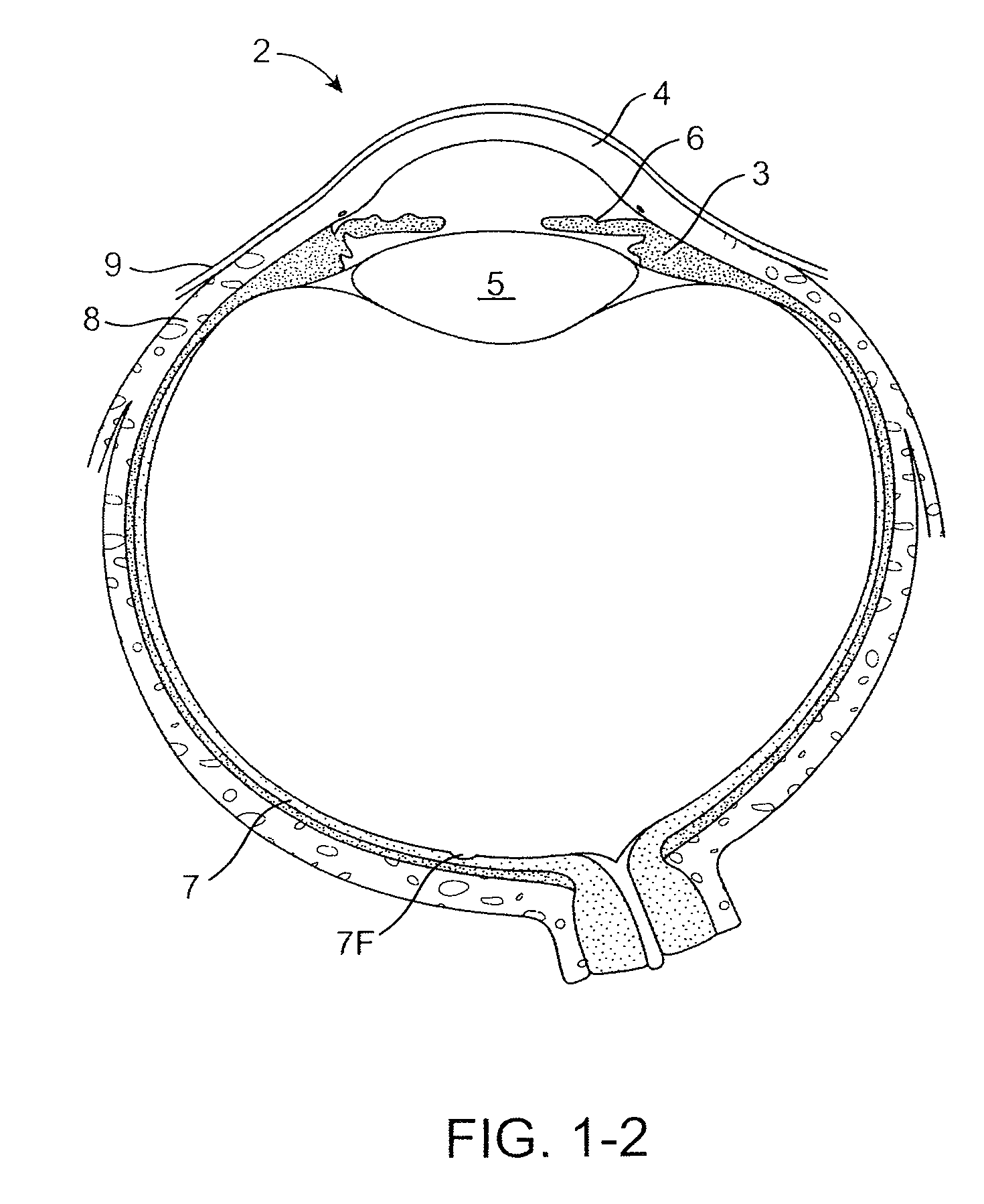 Drug Delivery Methods, Structures, and Compositions for Nasolacrimal System