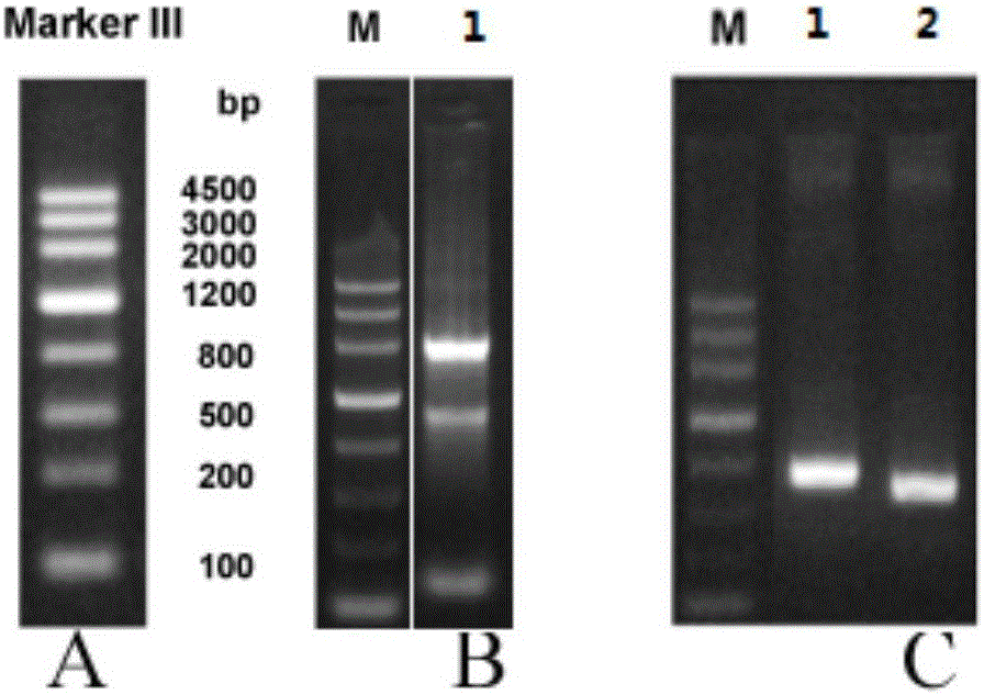 Human IL1RAP (IL-1 receptor accessory protein) specific CAR (chimeric antigen receptor) and application thereof