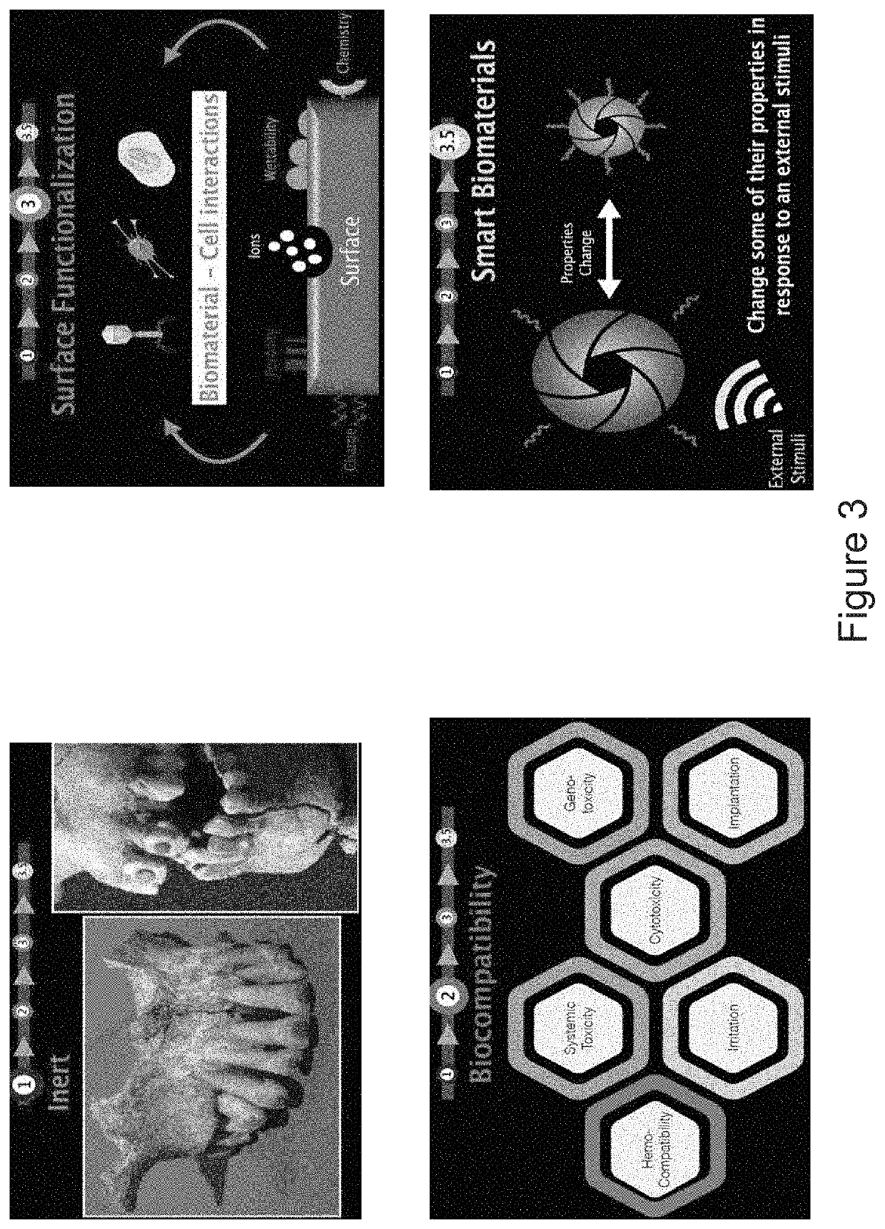 Smart composite with antibiofilm, mineralizing, and  antiinfection therapeutic effects