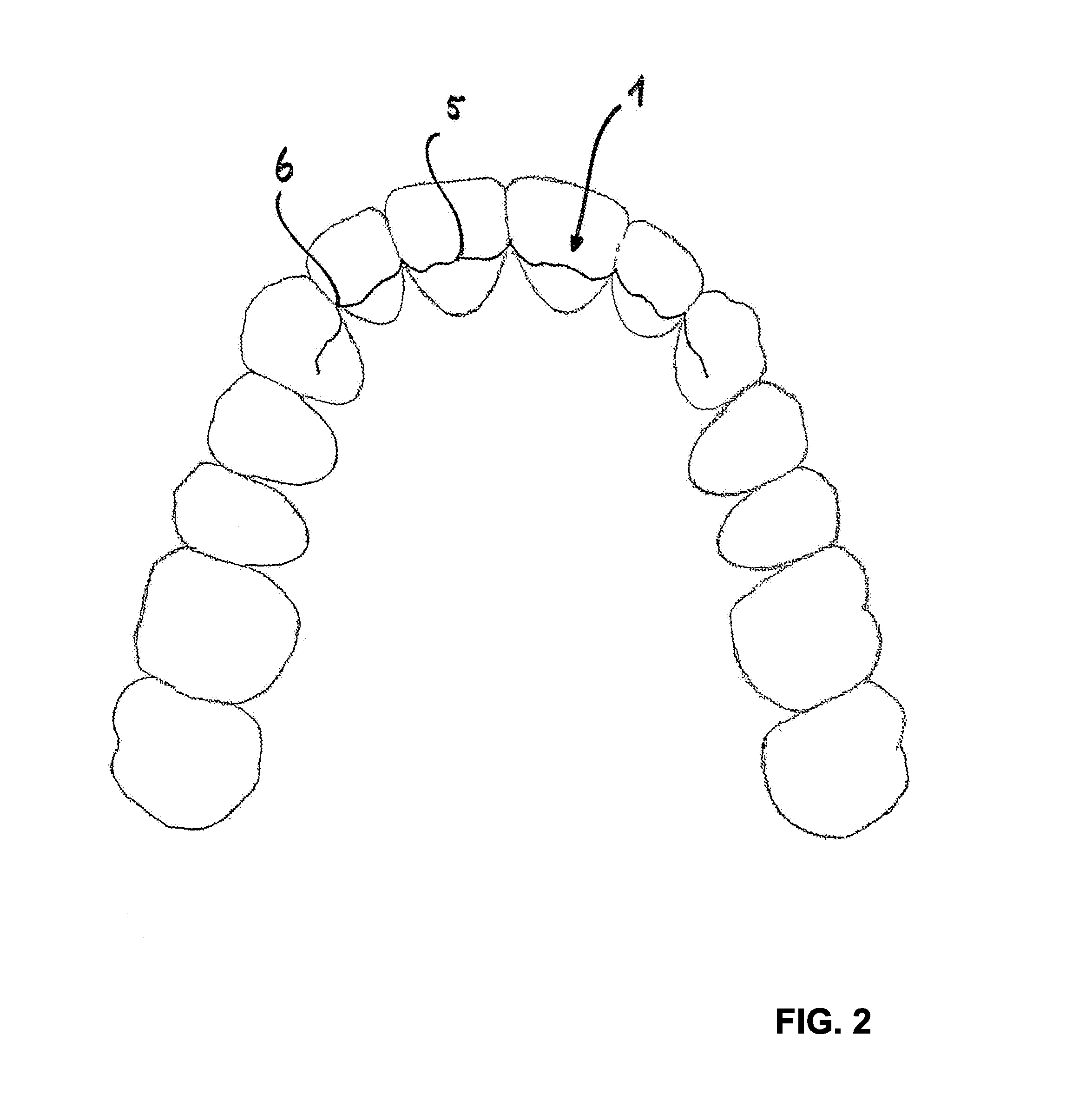 Retainer and method for production thereof